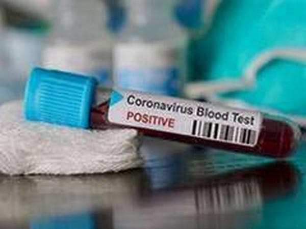 Bulgarian finance minister tests positive for coronavirus